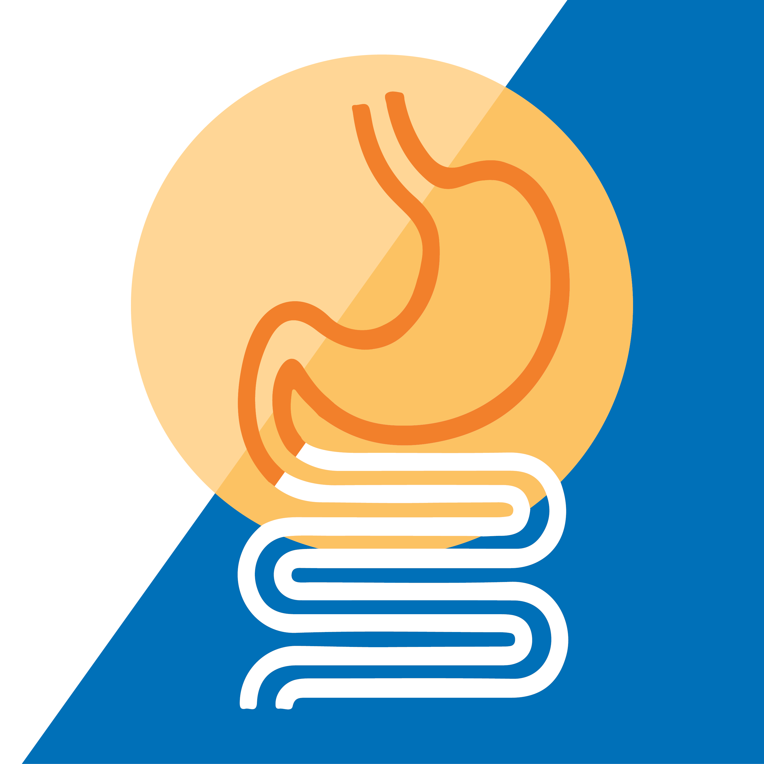 Cartoon image of the gastrointestinal symptom.  